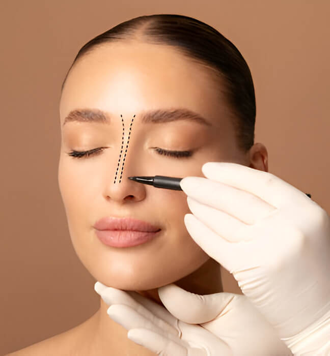 Operace nosu (rhinoplastika) v Turecko